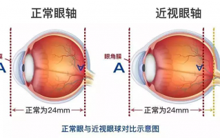 眼睛轴位1是什么意思，眼睛轴位1是什么意思？